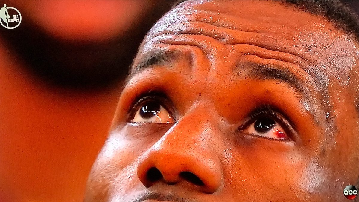 LeBron James red eye